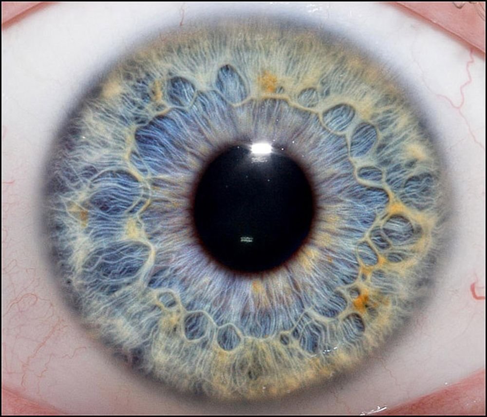 Chapter 2.3: The Color of the Iris