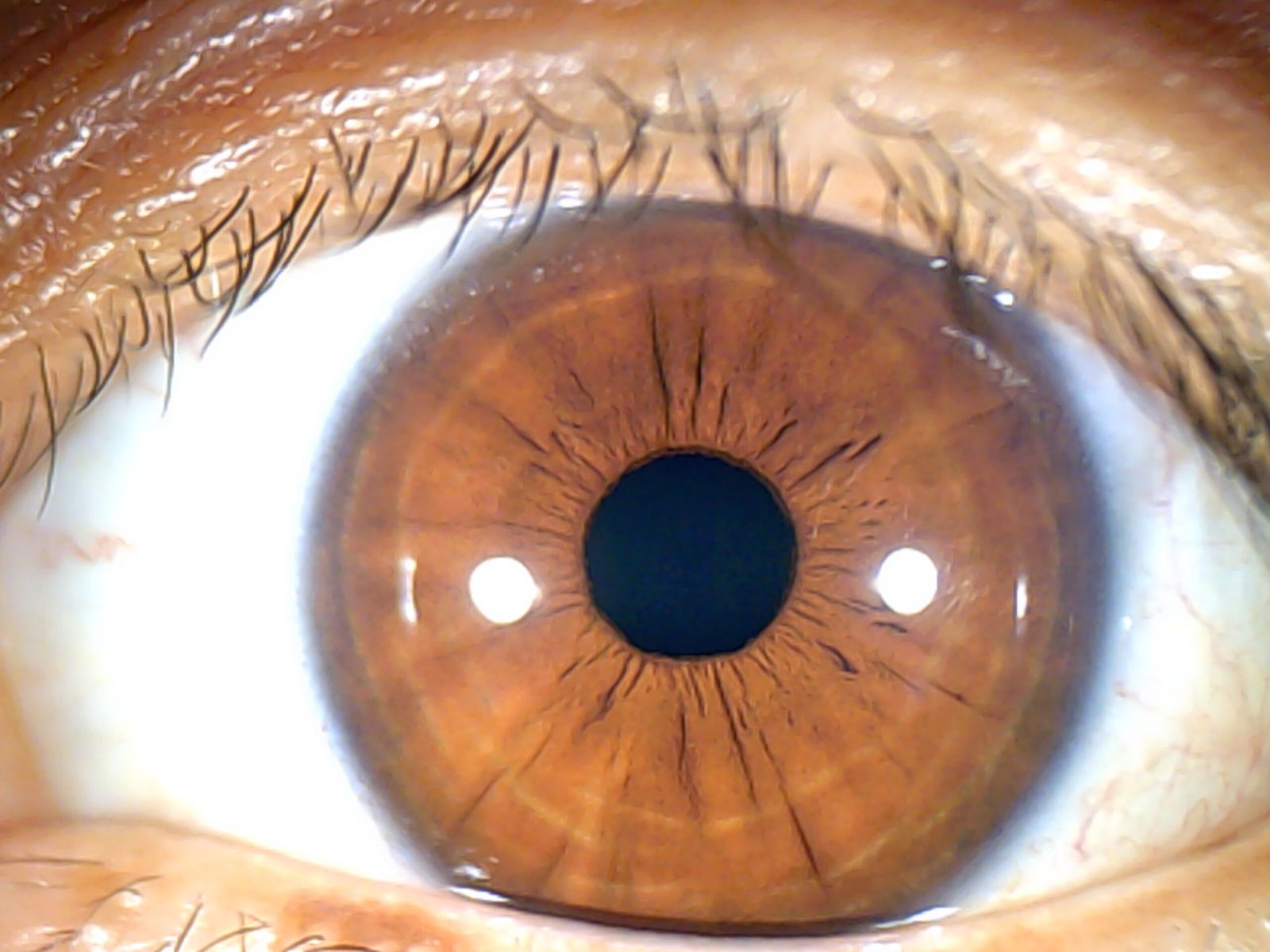 Chapter 2.3: The Color of the Iris