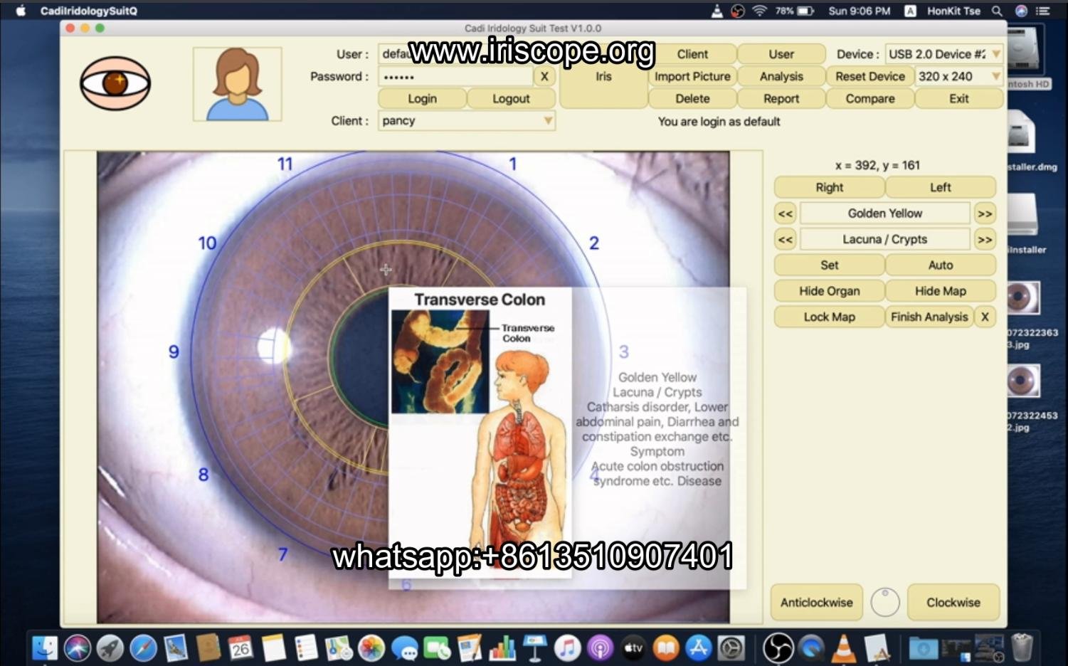 iridology software for mac