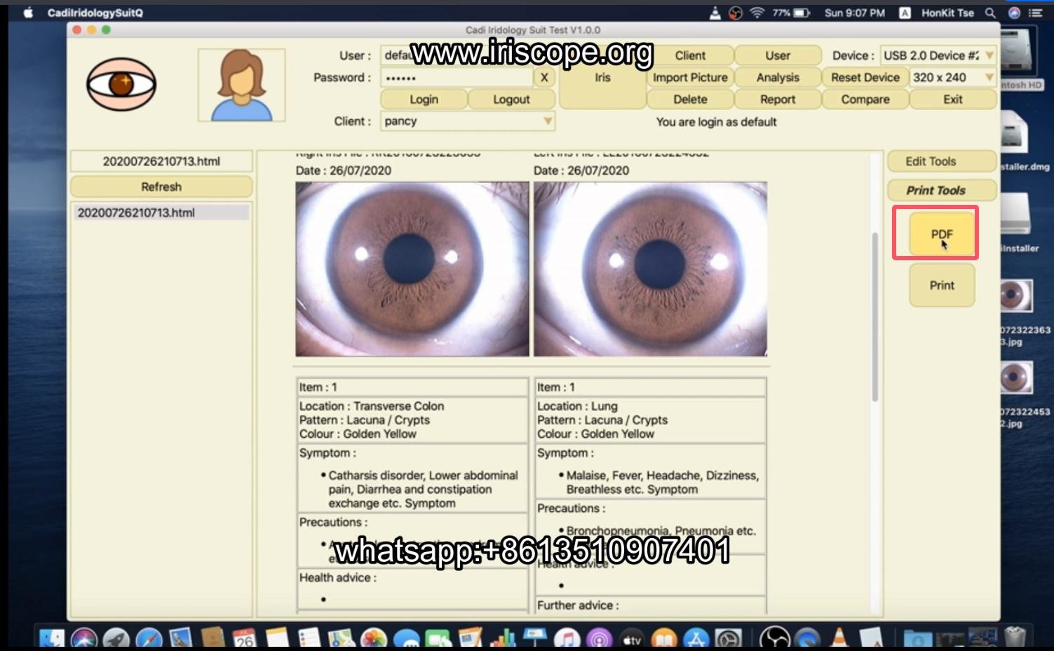 How to use maikong iridology software in apple mac os