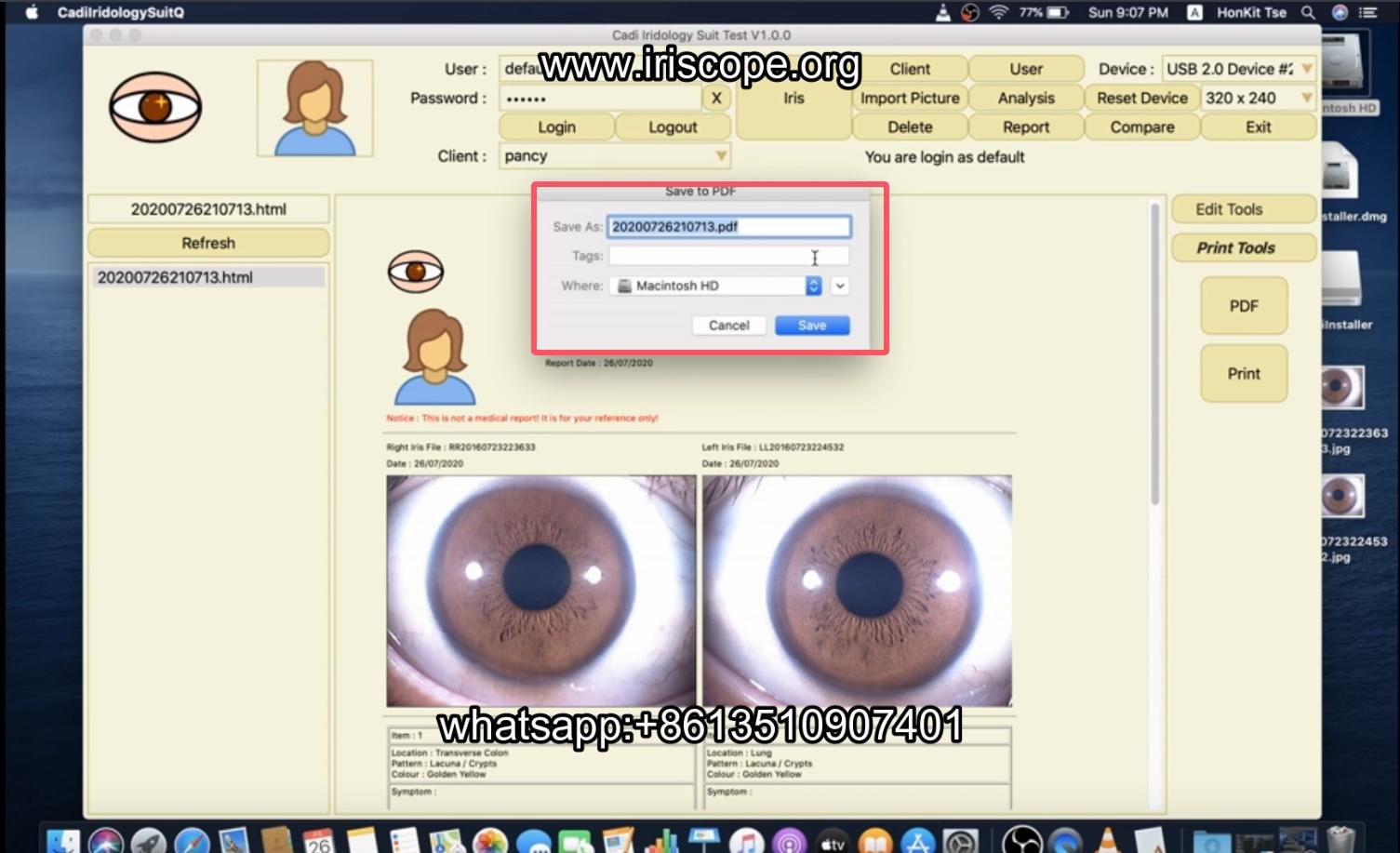 How to use maikong iridology software in apple mac os