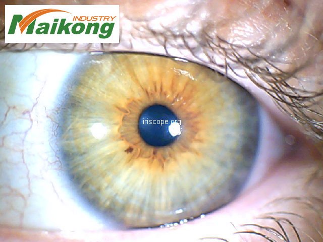 MAIKONG Professional 5MP 9815U Iridology Camera Iriscope 140