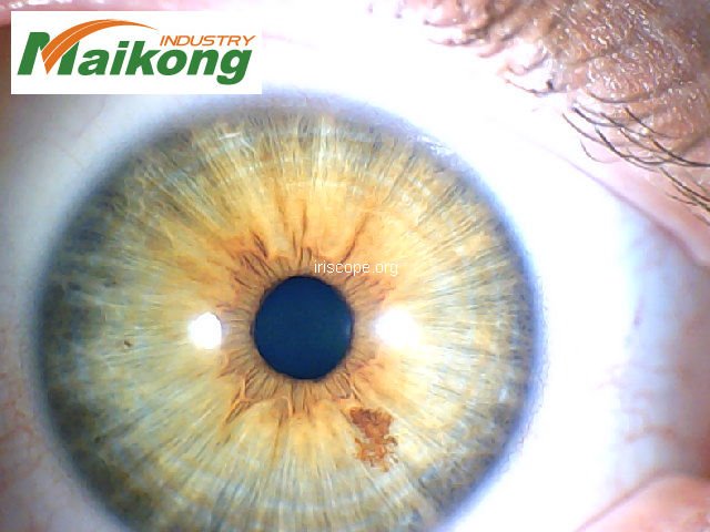 MAIKONG Professional 5MP 9815U Iridology Camera Iriscope 141