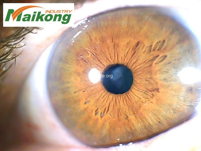 MAIKONG Professional 5MP 9815U Iridology Camera Iriscope 145