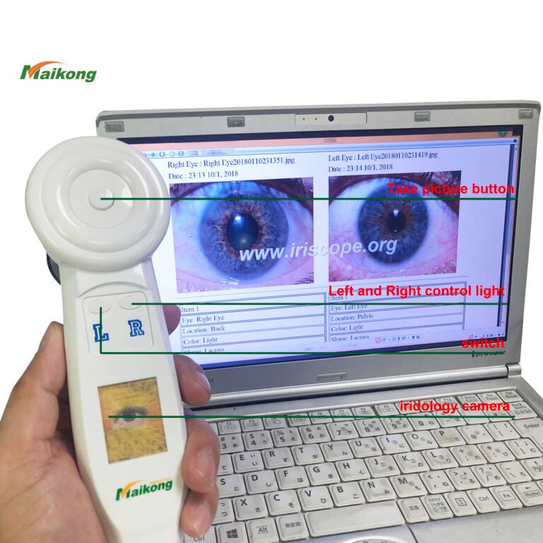 Iridology Camera