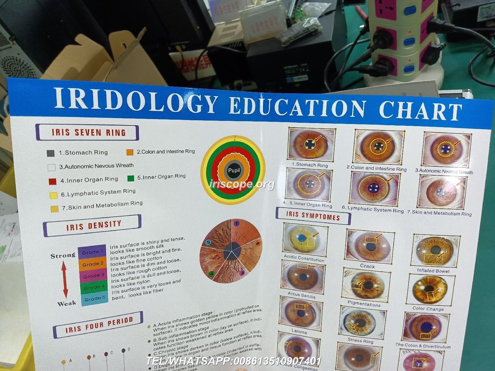 Iridology chart — a practical, clinic-ready guide for naturopaths in Australia — 00010.JPG