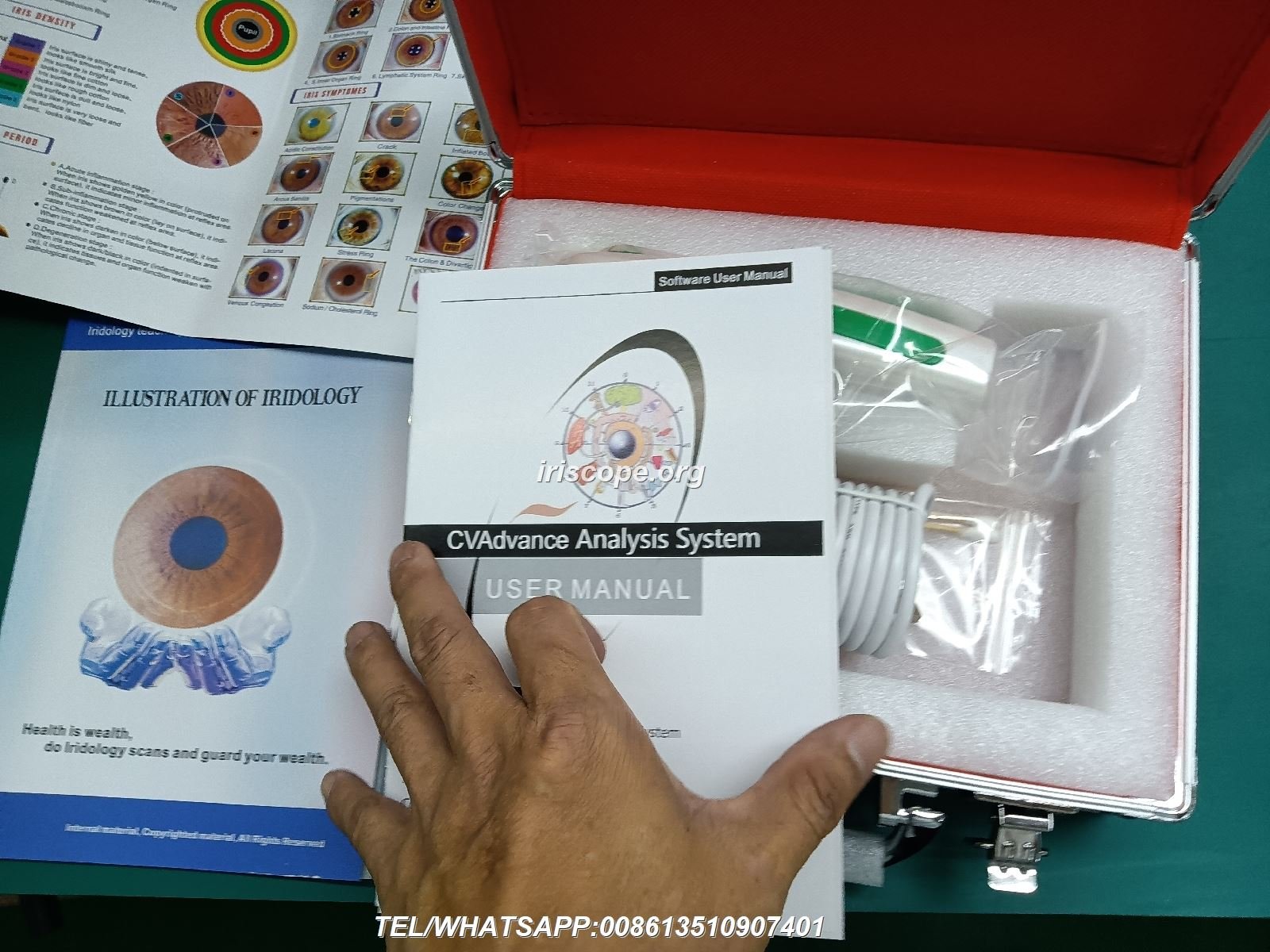How integrative wellness centres in Australia pick a reliable iridology camera wholesaler — 00012.JPG