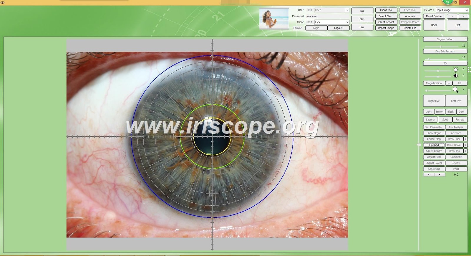 Where Australian private‑label brands can source professional iriscopes and what to check before you buy 8 Where Australian private‑label brands can source professional iriscopes and what to check before you buy — 035.JPG