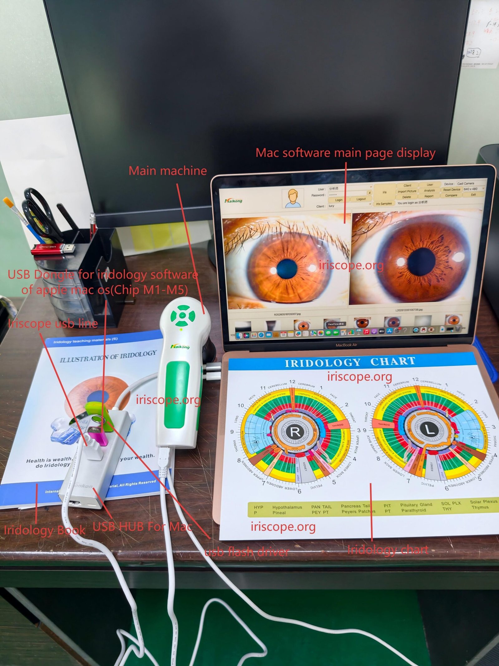 Where Australian private‑label brands can source professional iriscopes and what to check before you buy 7 Where Australian private‑label brands can source professional iriscopes and what to check before you buy — _20260519113123_1165_5.jpg