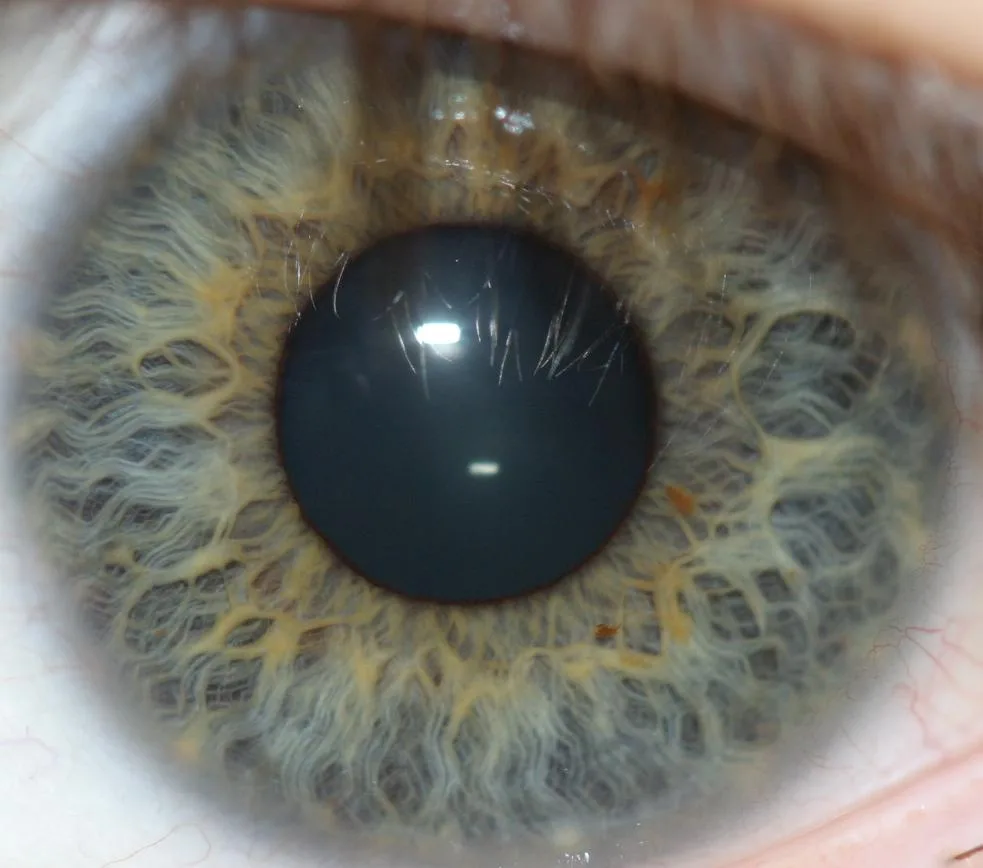 What +27 (14) 112-2334 means — a practical verification checklist for Australian online health equipment sellers — iridology brisbane 2.png
