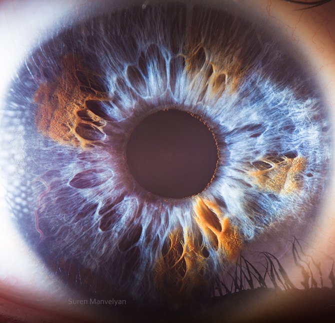 How integrative wellness centres in Australia pick a reliable iridology camera wholesaler — Iridología (11).JPG