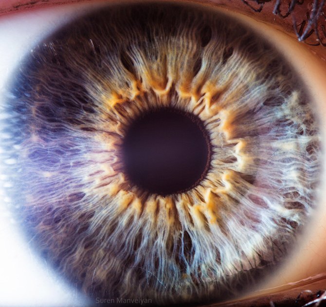 How integrative wellness centres in Australia pick a reliable iridology camera wholesaler — Iridología (12).JPG