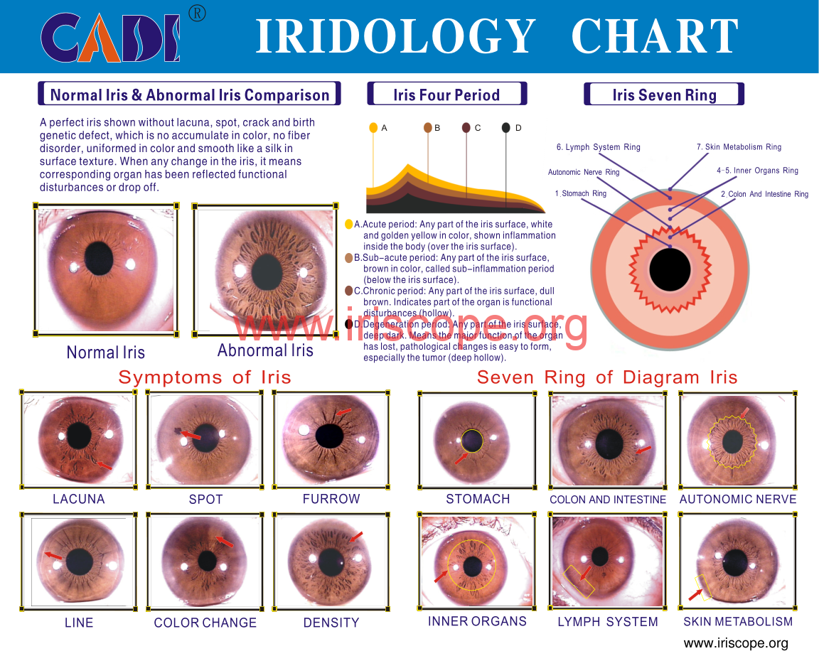 Who supplies iridology charts to the United States — practical suppliers and what to check 2 Which companies supply iridology chart to the United States? — MAIKONG Iridology CHART (2).png
