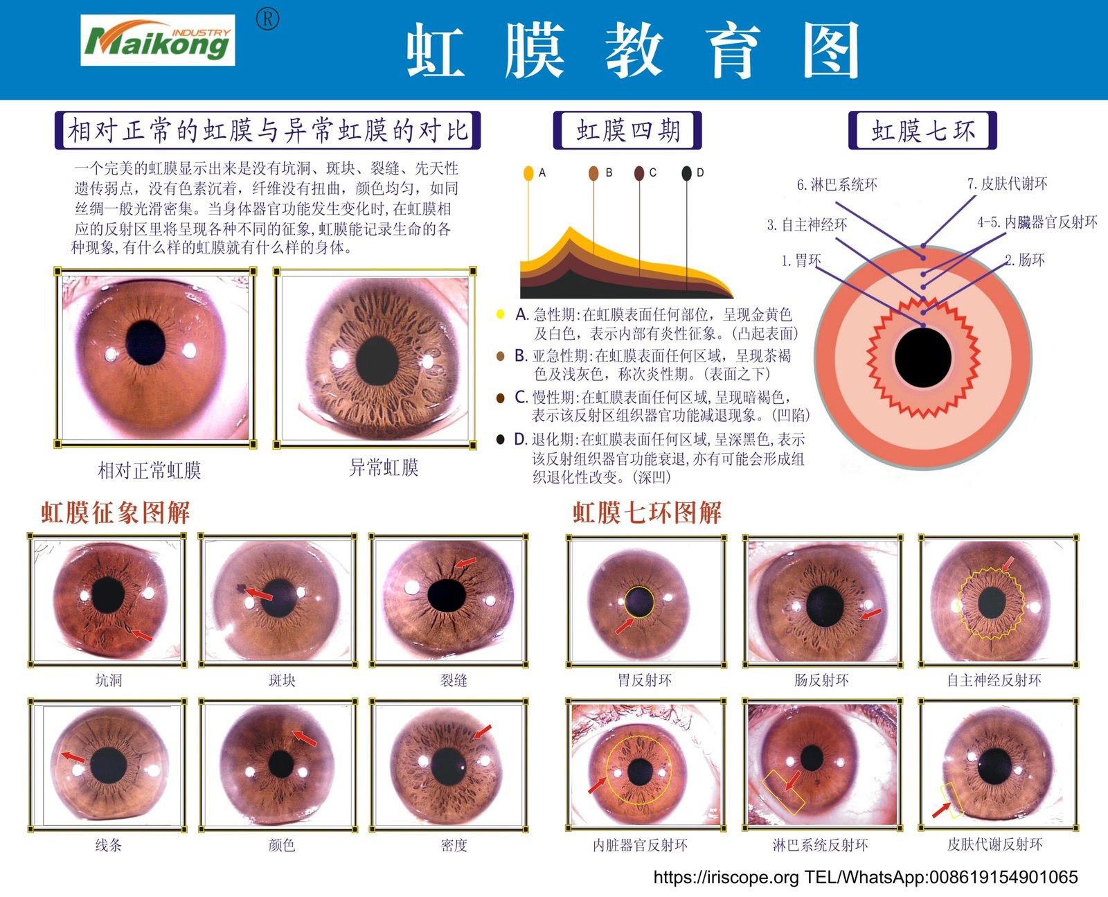 Designing a Practical Mobile Iris Imaging Kit for Australian Wellness Practitioners — MAIKONG iridologia mapa (24).jpg