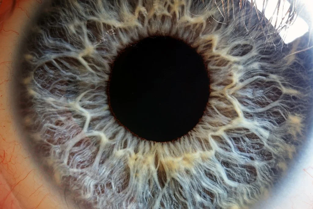 Iridology imaging in practice