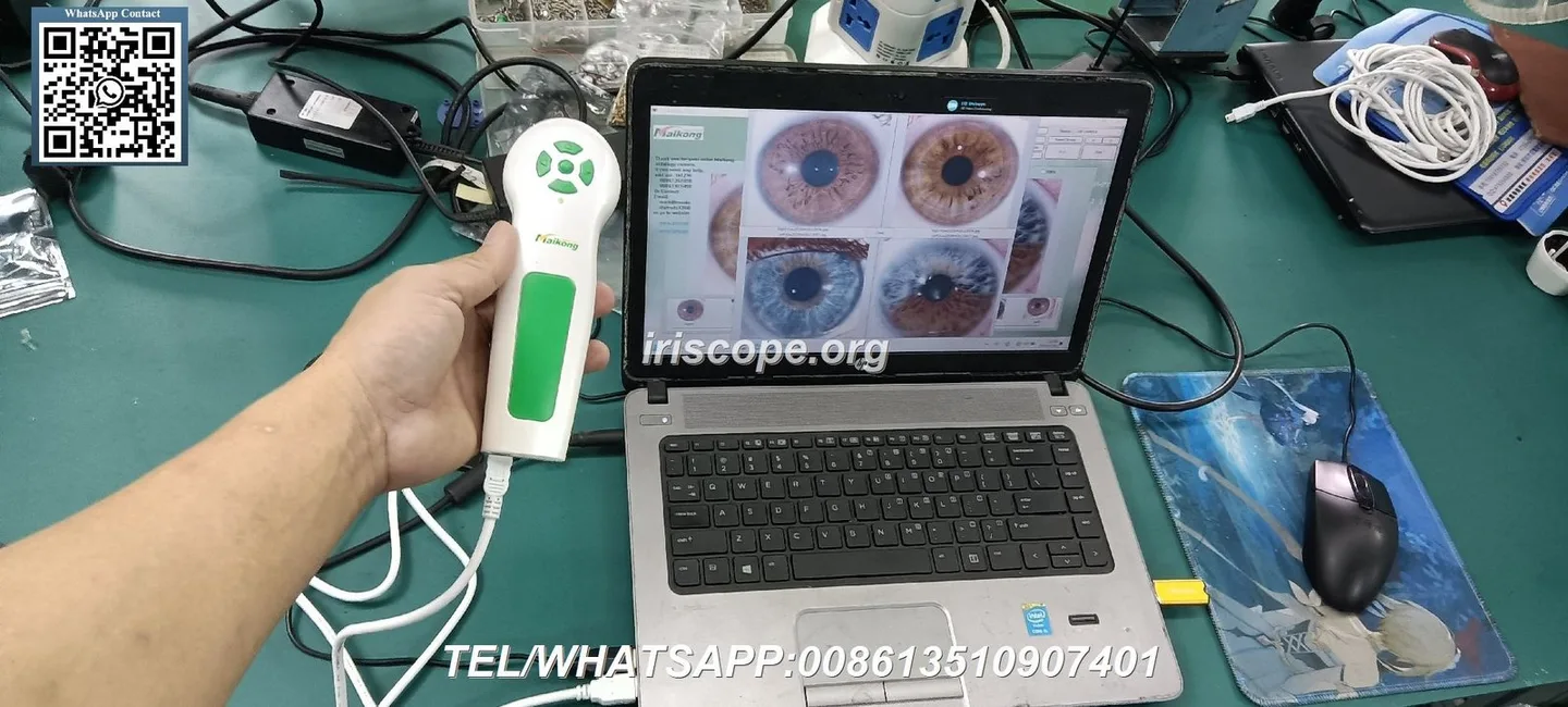 Where Australian private‑label brands can source professional iriscopes and what to check before you buy 6 Where Australian private‑label brands can source professional iriscopes and what to check before you buy — 096.JPG