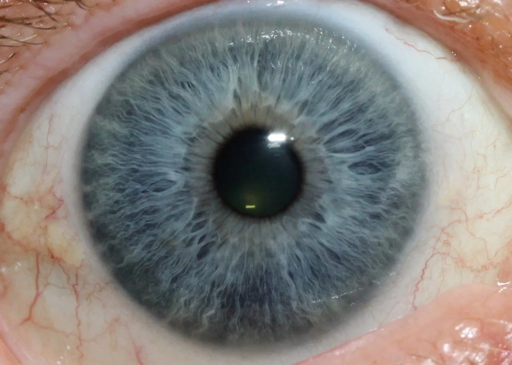 Which iridology camera should my Australian clinic or training school choose — what to compare and why 1 Which iridology camera should my Australian clinic or training school choose — what to compare and why — iridology images 18.jpg