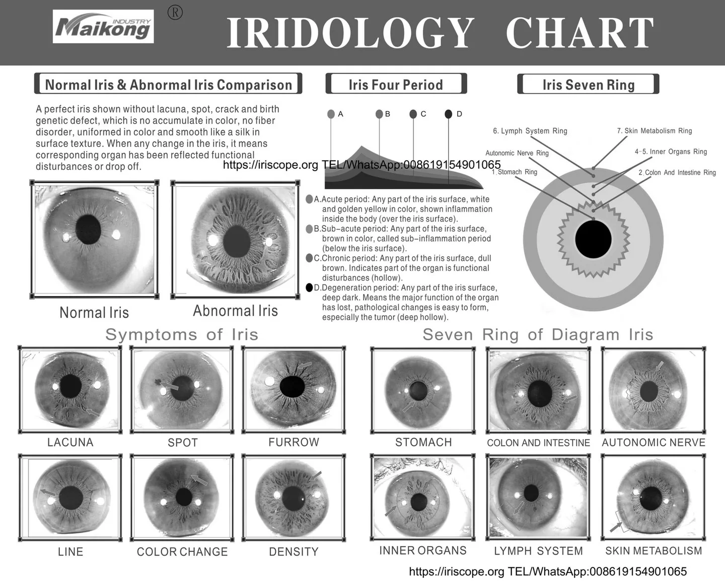 Designing a reliable dual‑station iris imaging consultation room for Australian iridology clinics — MAIKONG iridologia mapa (15).jpg