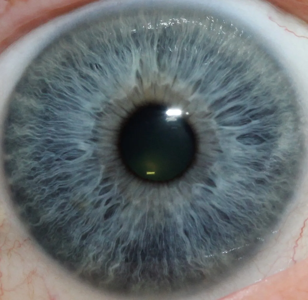 Where to find a useful free iridology course online — a practical guide for Australian private‑label health equipment brands — 004-1.jpg