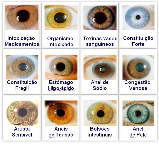 Iridology chart — a practical, clinic-ready guide for naturopaths in Australia — jensen iridology chart (5).jpg