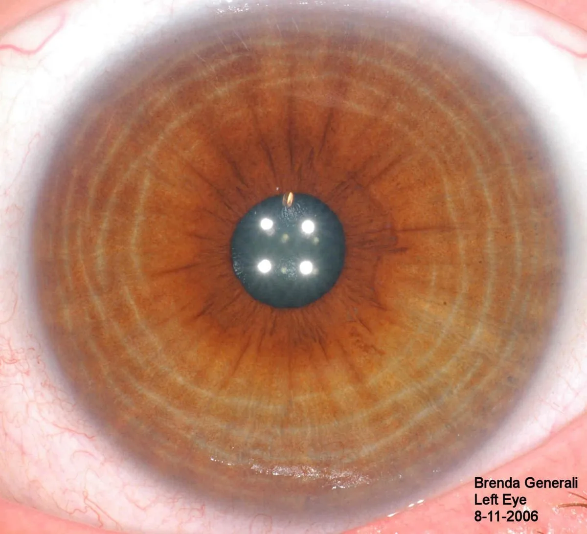 Iridology near me: a practical sourcing and reseller checklist for Australian health‑tech resellers — Iridología (13).JPG