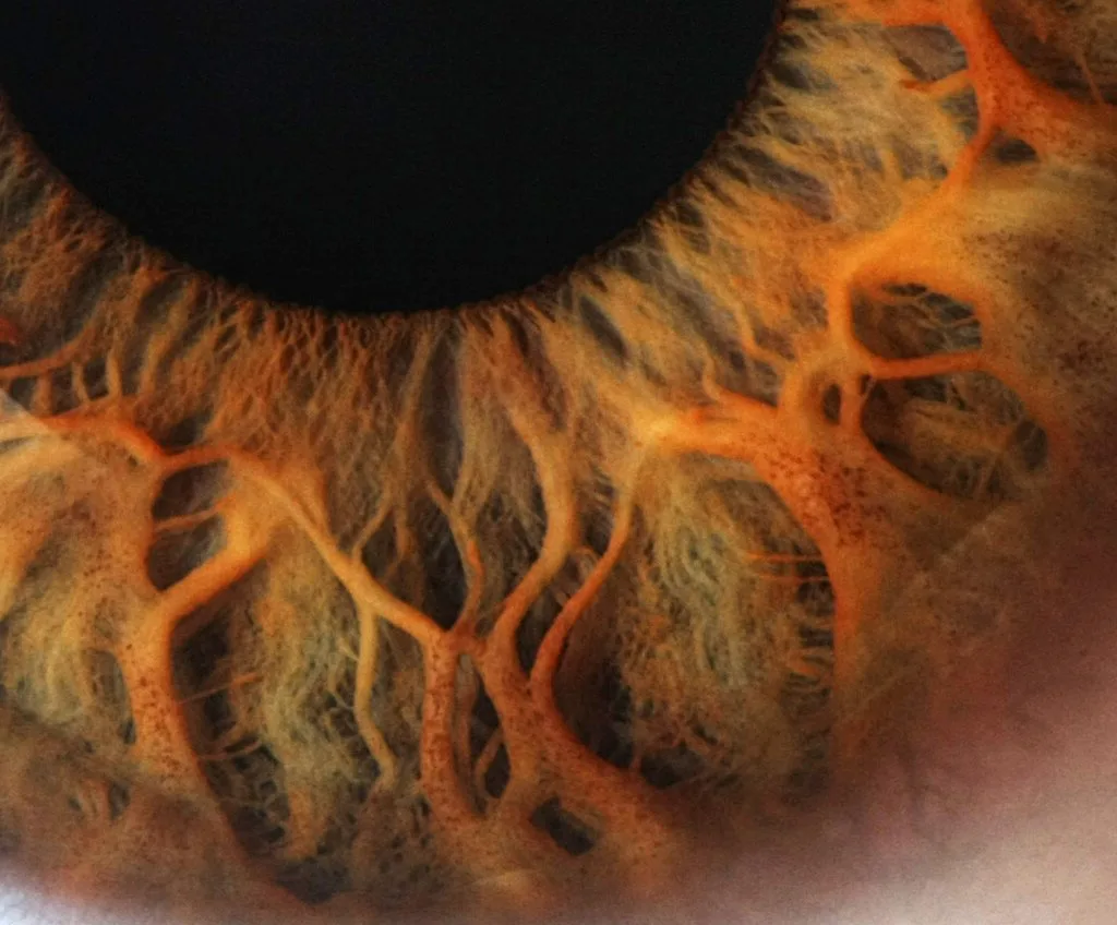 Iridology near me: a practical sourcing and reseller checklist for Australian health‑tech resellers — Iridología (4).jpg