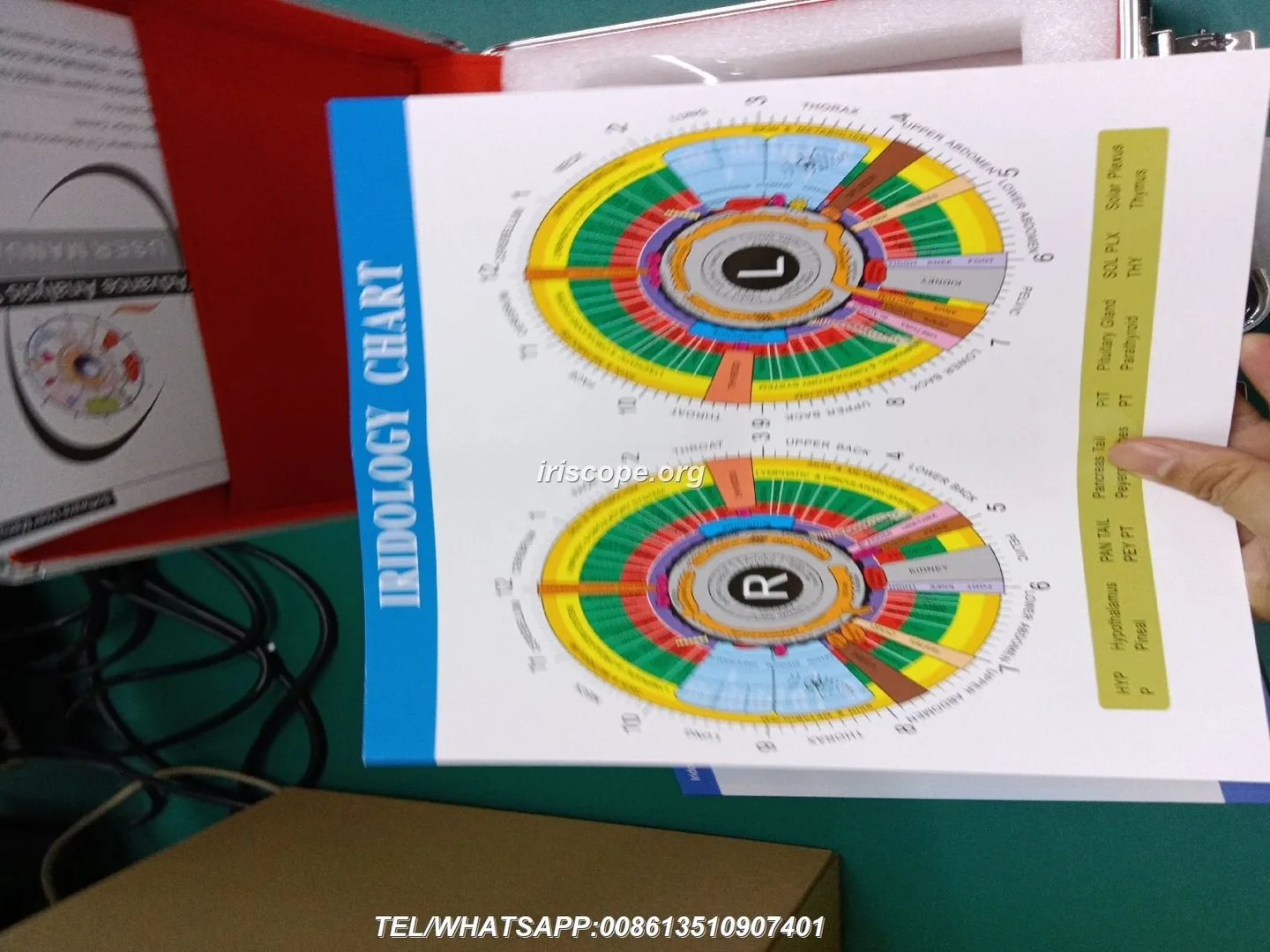What leading iridology software and camera providers offer — a practical guide for Australian complementary health centres 7 What leading iridology software and camera providers offer — a practical guide for Australian complementary health centres — 00007.JPG