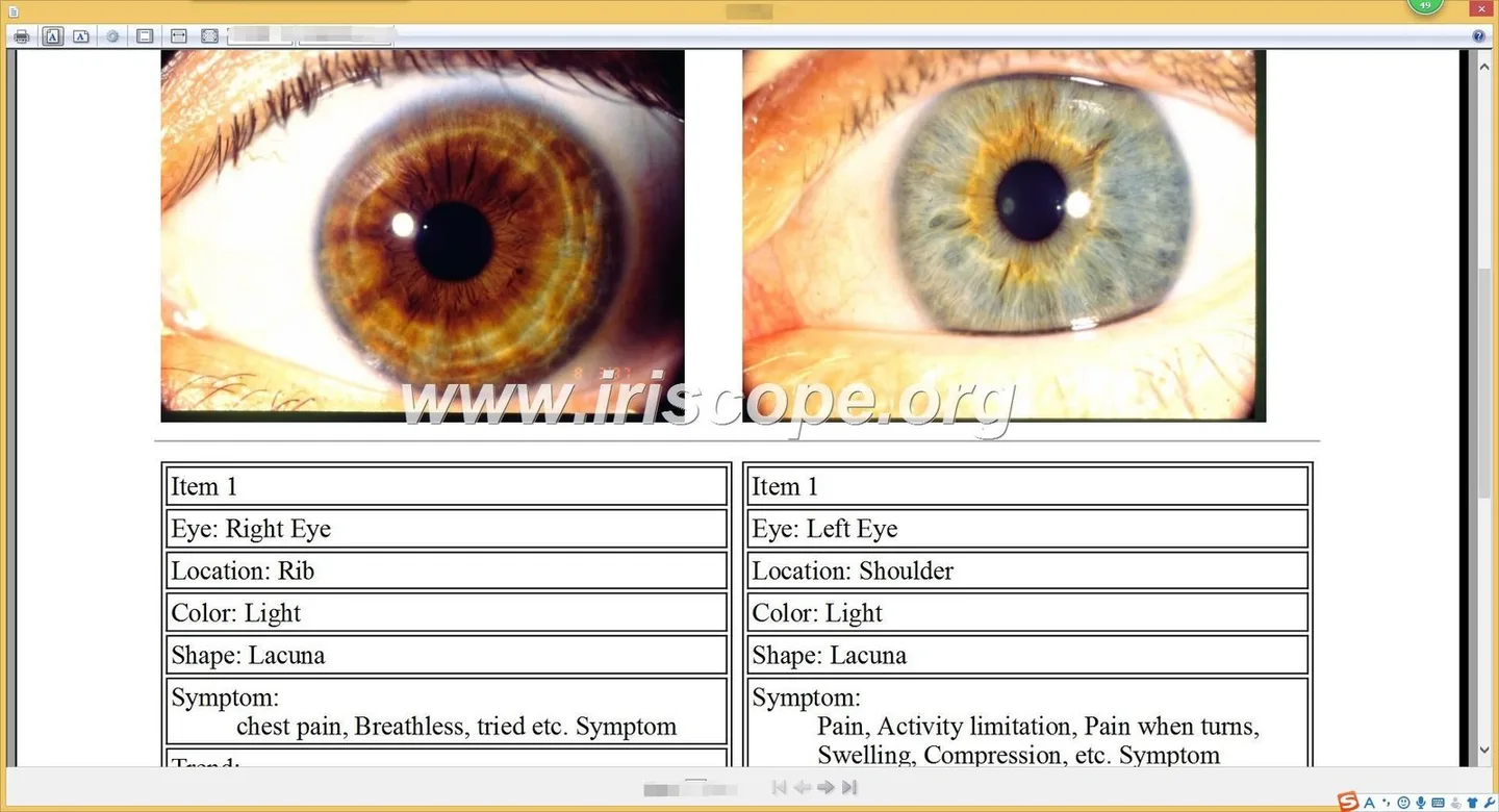 What leading iridology software and camera providers offer — a practical guide for Australian complementary health centres 3 What leading iridology software and camera providers offer — a practical guide for Australian complementary health centres — 025.JPG