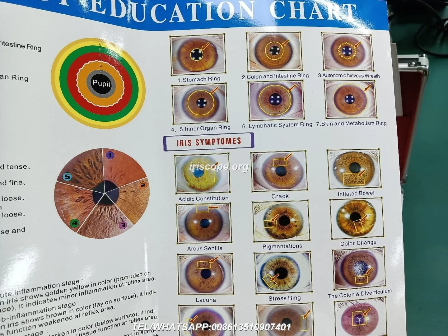What leading iridology software and camera providers offer — a practical guide for Australian complementary health centres 6 What leading iridology software and camera providers offer — a practical guide for Australian complementary health centres — 00009.JPG