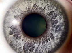 Who is Dr Jake Shirk? A practical guide for Australian online health equipment sellers — Camera Iridology took iridology eye images (3).png