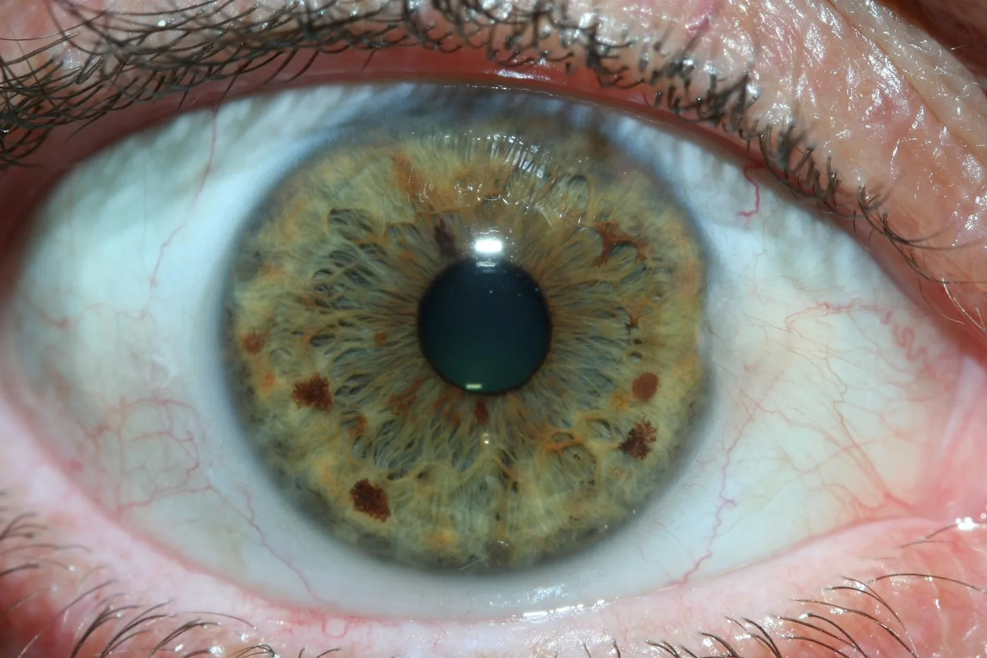 Choosing an iriscope manufacturer in Australia: practical guidance for professional iridologists — iridology eys images 6.jpg