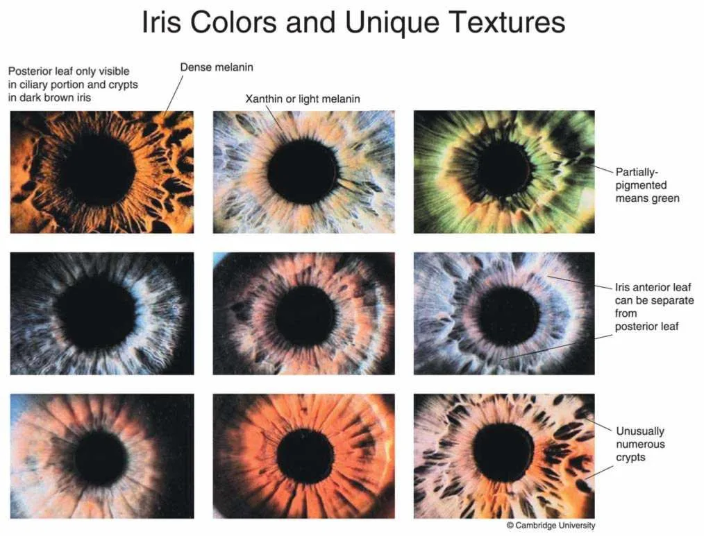 Looking for an “Amish iridologist near me” in Australia — practical options for OEM distributors — iridology images eye seasons spring eyes 2.jpg