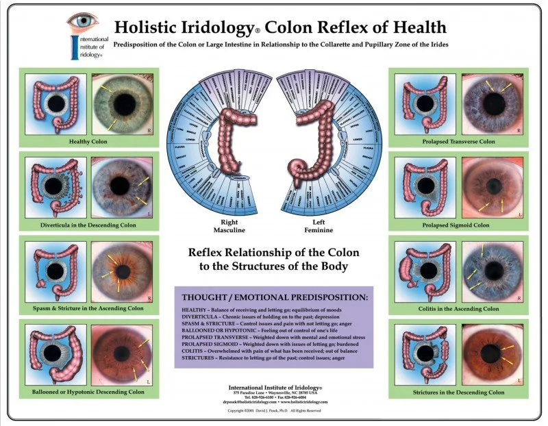 Looking for an “Amish iridologist near me” in Australia — practical options for OEM distributors — iridology images eye seasons spring eyes 4.jpg