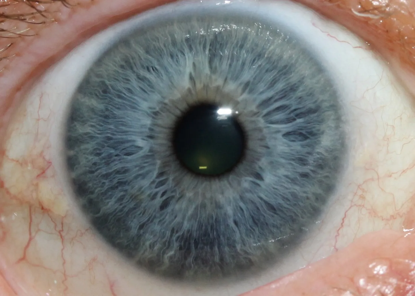 Choosing an iriscope manufacturer in Australia: practical guidance for professional iridologists — iridology eys images 8.jpg