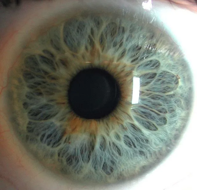 Where to find a useful free iridology course online — a practical guide for Australian private‑label health equipment brands — red ring around iris (5).jpg