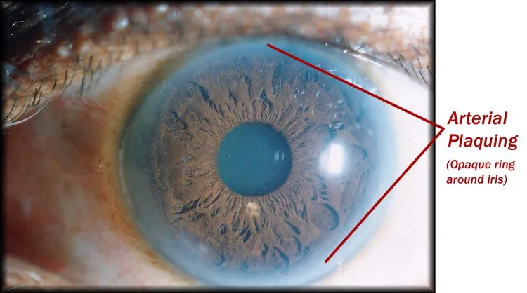 Designing a Practical Mobile Iris Imaging Kit for Australian Wellness Practitioners — iridoligy (7).jpg