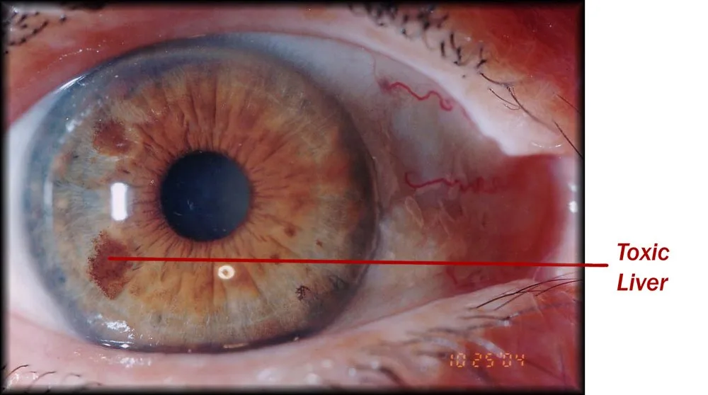 Designing a Practical Mobile Iris Imaging Kit for Australian Wellness Practitioners — iridoligy (10).jpg