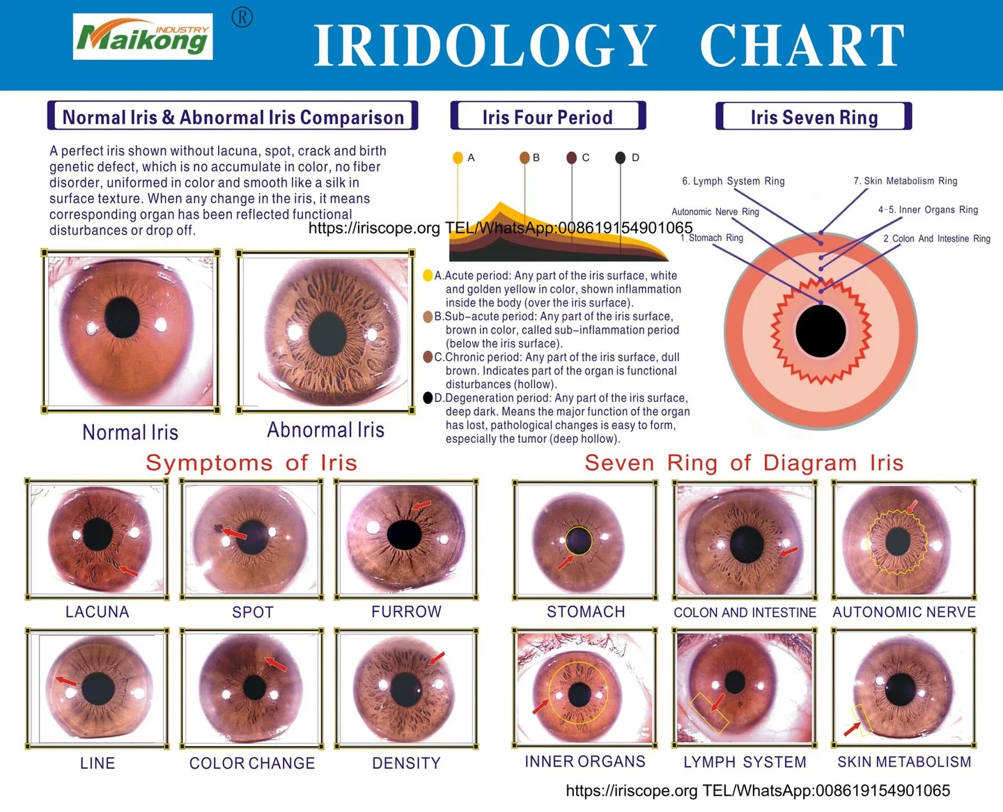 Which iriscope should Australian professional iridologists choose? A practical recommendation — MAIKONG iridologia mapa (25).jpg