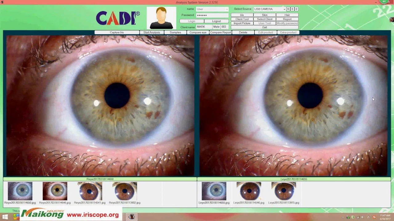 Before you buy: how to compare iridology equipment on the same dimensions, evidence and suitability for Australia — Camera Iridology iridology software (4).jpg