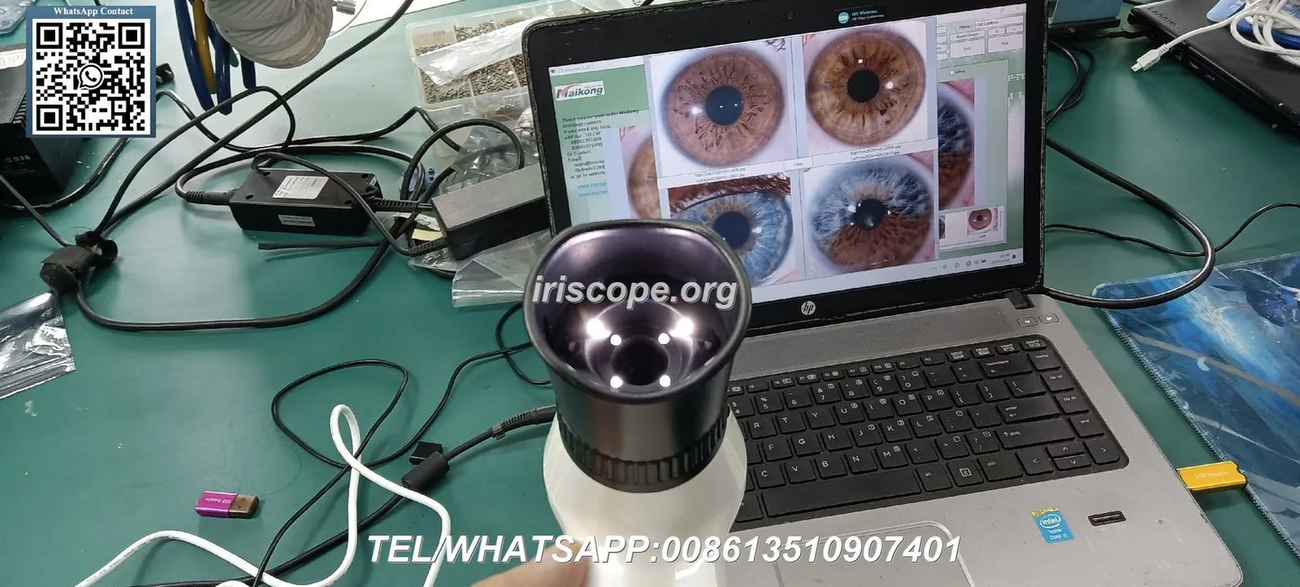 Before you buy: how to compare iridology equipment on the same dimensions, evidence and suitability for Australia — 085.JPG