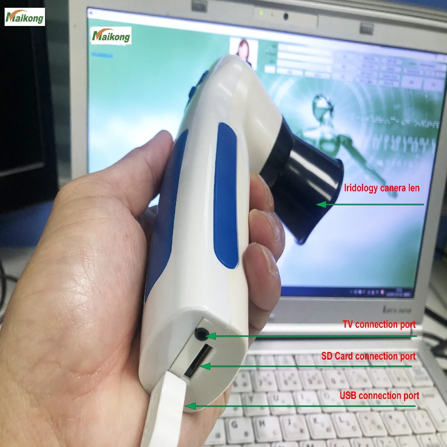 Before you buy: how to compare iridology equipment on the same dimensions, evidence and suitability for Australia — 0007.JPG