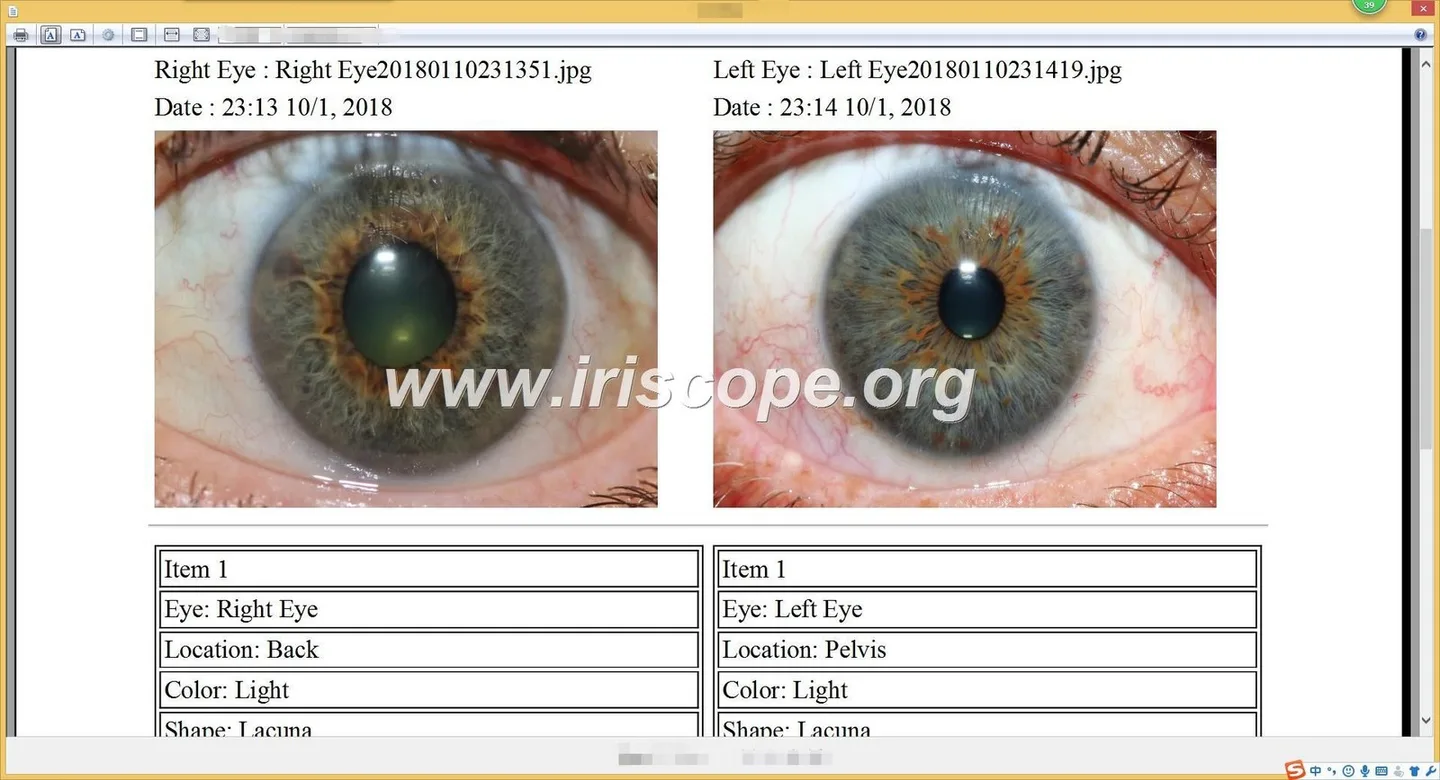 Who are the leading iridology software providers and why — a practical guide for Australian importers 3 Who are the leading iridology software providers and why — a practical guide for Australian importers — 051.JPG